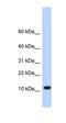 Transmembrane Protein 254 antibody, orb325523, Biorbyt, Western Blot image 