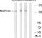 Nucleoporin 160 antibody, TA312716, Origene, Western Blot image 