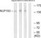 Nucleoporin 160 antibody, TA312716, Origene, Western Blot image 