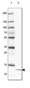 Coiled-Coil Domain Containing 167 antibody, NBP1-94107, Novus Biologicals, Western Blot image 