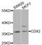 Caudal Type Homeobox 2 antibody, LS-C331597, Lifespan Biosciences, Western Blot image 