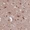 HYLS1 Centriolar And Ciliogenesis Associated antibody, PA5-59480, Invitrogen Antibodies, Immunohistochemistry paraffin image 