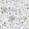 LIM Homeobox Transcription Factor 1 Beta antibody, A6386, ABclonal Technology, Immunohistochemistry paraffin image 