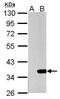 Gal-4 antibody, GTX114527, GeneTex, Western Blot image 