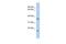 Methylenetetrahydrofolate Dehydrogenase (NADP+ Dependent) 2 Like antibody, PA5-44491, Invitrogen Antibodies, Western Blot image 