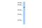 Small Nuclear RNA Activating Complex Polypeptide 1 antibody, PA5-68512, Invitrogen Antibodies, Western Blot image 