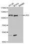 LIG3 antibody, LS-B14872, Lifespan Biosciences, Western Blot image 