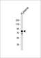 Vitronectin antibody, GTX81434, GeneTex, Western Blot image 