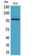 SAM And HD Domain Containing Deoxynucleoside Triphosphate Triphosphohydrolase 1 antibody, STJ96856, St John