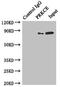 Protein Kinase C Epsilon antibody, orb352957, Biorbyt, Immunoprecipitation image 