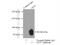 GLI Family Zinc Finger 3 antibody, 19949-1-AP, Proteintech Group, Immunoprecipitation image 