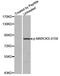 Myristoylated Alanine Rich Protein Kinase C Substrate antibody, MBS128317, MyBioSource, Western Blot image 