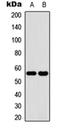 ATPase Na+/K+ Transporting Subunit Alpha 1 antibody, orb304689, Biorbyt, Western Blot image 