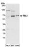 Transducin beta-like protein 2 antibody, A305-081A, Bethyl Labs, Western Blot image 