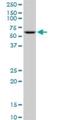 Glycerol Kinase 2 antibody, H00002712-B01P, Novus Biologicals, Western Blot image 