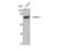 LIM domain kinase 2 antibody, STJ93932, St John