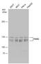Poly(ADP-Ribose) Glycohydrolase antibody, GTX130002, GeneTex, Western Blot image 