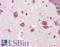Thymic Stromal Lymphopoietin antibody, LS-B3208, Lifespan Biosciences, Immunohistochemistry paraffin image 