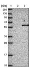 Actin Related Protein 6 antibody, NBP1-89001, Novus Biologicals, Western Blot image 