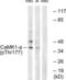 Calcium/Calmodulin Dependent Protein Kinase I antibody, LS-C198718, Lifespan Biosciences, Western Blot image 