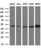 Phosphoribosylaminoimidazole Carboxylase And Phosphoribosylaminoimidazolesuccinocarboxamide Synthase antibody, M07031, Boster Biological Technology, Western Blot image 