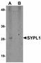 Synaptophysin Like 1 antibody, LS-B5017, Lifespan Biosciences, Western Blot image 
