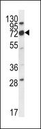 EWI-2 antibody, LS-C165162, Lifespan Biosciences, Western Blot image 