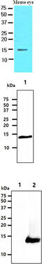 Cellular Retinoic Acid Binding Protein 1 antibody, MBS200159, MyBioSource, Western Blot image 