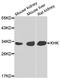 Ketohexokinase antibody, LS-C349140, Lifespan Biosciences, Western Blot image 