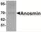 Anosmin 1 antibody, NBP1-76580, Novus Biologicals, Western Blot image 