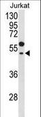 G Protein Subunit Alpha Transducin 1 antibody, LS-C166551, Lifespan Biosciences, Western Blot image 