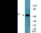 Cyclic AMP-dependent transcription factor ATF-2 antibody, EKC2356, Boster Biological Technology, Western Blot image 