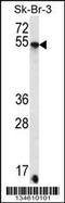 Syndecan 3 antibody, 57-917, ProSci, Western Blot image 