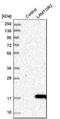 Late Endosomal/Lysosomal Adaptor, MAPK And MTOR Activator 2 antibody, NBP1-87951, Novus Biologicals, Western Blot image 