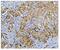 BUB1 Mitotic Checkpoint Serine/Threonine Kinase B antibody, A01564-1, Boster Biological Technology, Immunohistochemistry paraffin image 