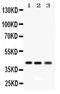 RAGE antibody, PA5-78736, Invitrogen Antibodies, Western Blot image 