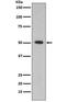 Aldehyde Dehydrogenase 1 Family Member A1 antibody, M01392-1, Boster Biological Technology, Western Blot image 