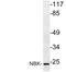 BCL2 Interacting Killer antibody, AP06031PU-N, Origene, Western Blot image 