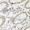 Ubiquitin Protein Ligase E3A antibody, A1757, ABclonal Technology, Immunohistochemistry paraffin image 