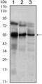 ETS Variant 5 antibody, abx010753, Abbexa, Enzyme Linked Immunosorbent Assay image 