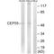 Centrosomal Protein 55 antibody, A03954, Boster Biological Technology, Western Blot image 