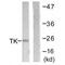 Thymidine Kinase 1 antibody, MBS9401946, MyBioSource, Western Blot image 