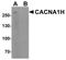 Calcium Voltage-Gated Channel Subunit Alpha1 H antibody, PA5-72836, Invitrogen Antibodies, Western Blot image 
