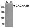 Calcium Voltage-Gated Channel Subunit Alpha1 H antibody, PA5-72836, Invitrogen Antibodies, Western Blot image 