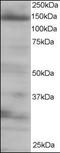Eukaryotic Translation Initiation Factor 4E Nuclear Import Factor 1 antibody, orb88104, Biorbyt, Western Blot image 