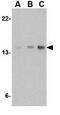 Stathmin 1 antibody, GTX31759, GeneTex, Western Blot image 