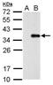 Collagen Type XI Alpha 2 Chain antibody, GTX128012, GeneTex, Western Blot image 
