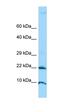 Adenosine Deaminase TRNA Specific 2 antibody, orb326610, Biorbyt, Western Blot image 