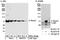 RecQ Like Helicase antibody, A300-447A, Bethyl Labs, Immunoprecipitation image 