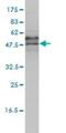 Eukaryotic Translation Initiation Factor 5 antibody, H00001983-M01, Novus Biologicals, Western Blot image 